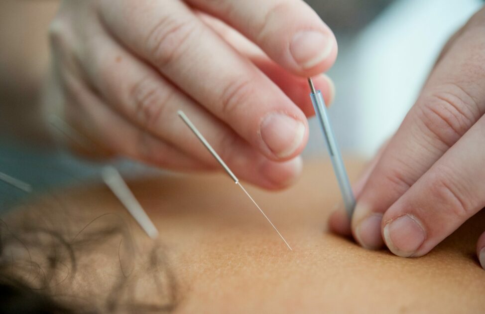 Patient Left on Pins and Needles